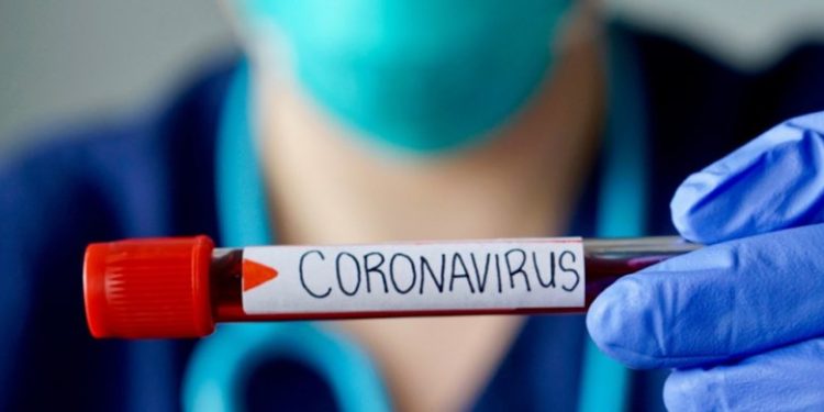 فيروس كورونا : 864 إصابة جديدة و 16 حالة وفاة