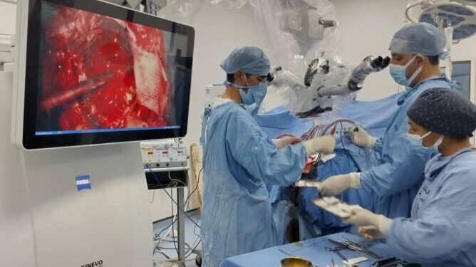 نجاح طبي جديد: استئصال دقيق لورم دماغي بتقنية متطورة