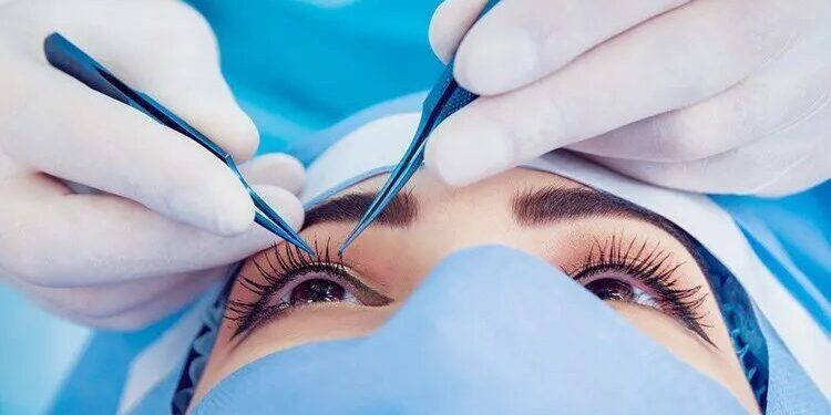 تخصيص حافلة طبية مجهزة بمعدات طب العيون لتقديم العلاج في المناطق الداخلية